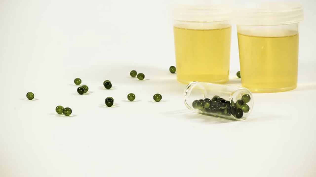 Does CBD Show Up in Drug Tests