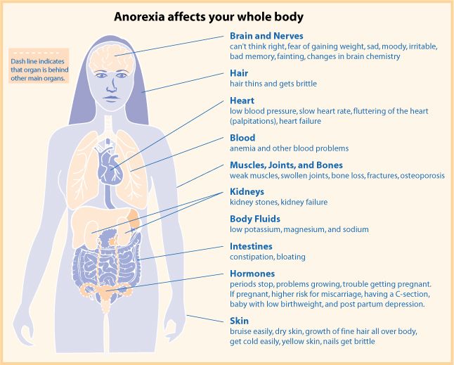 anorexia food
