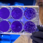 Use of CBD to Reduce the Antibiotics Harm for the Human Body