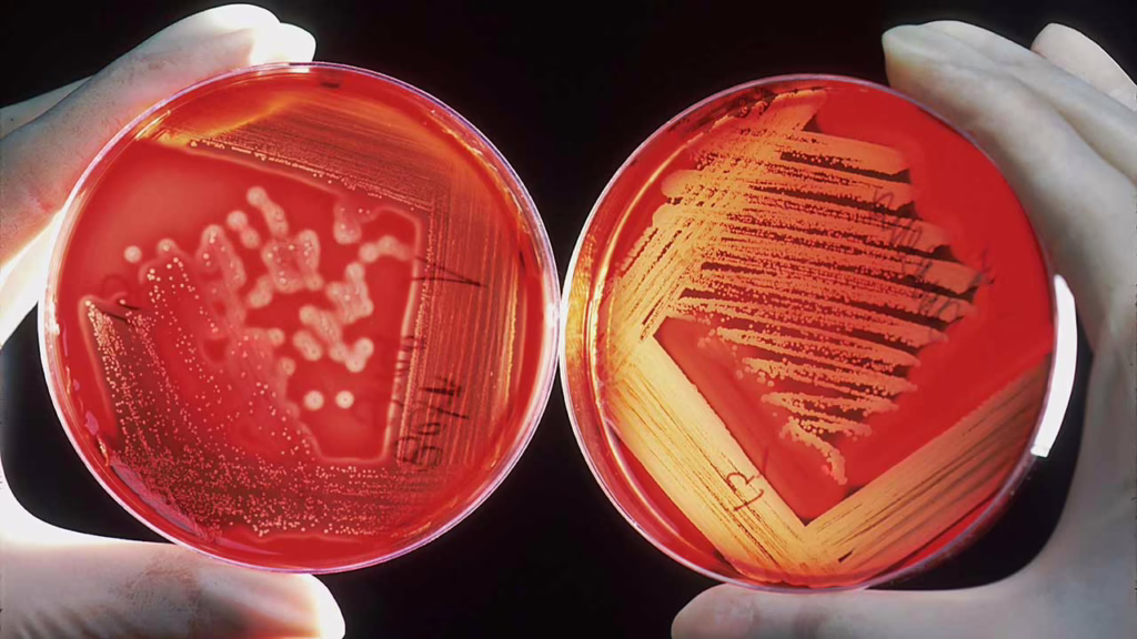 CBD and CBDV Study Shows Rapid Knockout Power Against Fungi